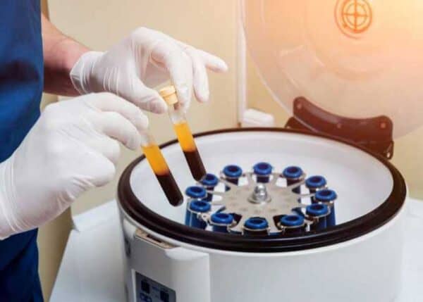 Platelet Injection For Plantar Fasciitis